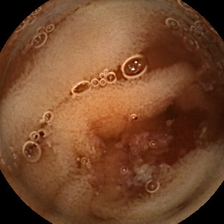 Main diagnostic image